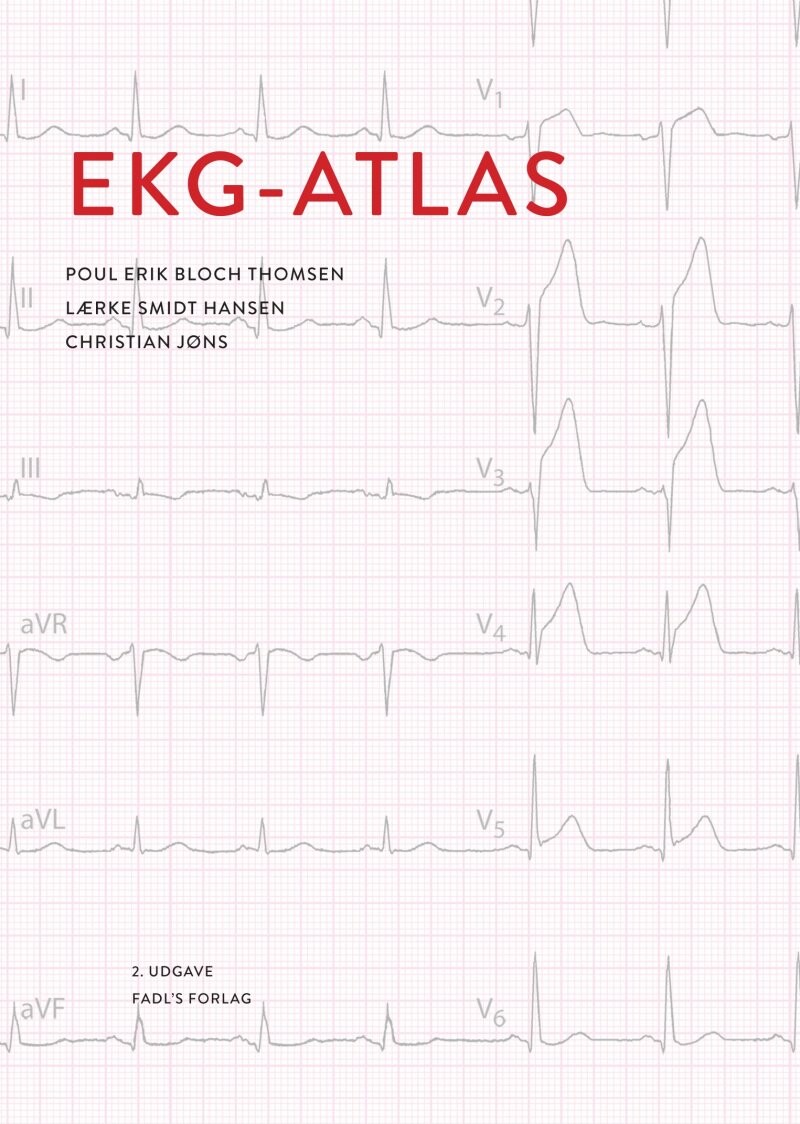 Ekg Atlas   Poul Erik Bloch Thomsen   Bog