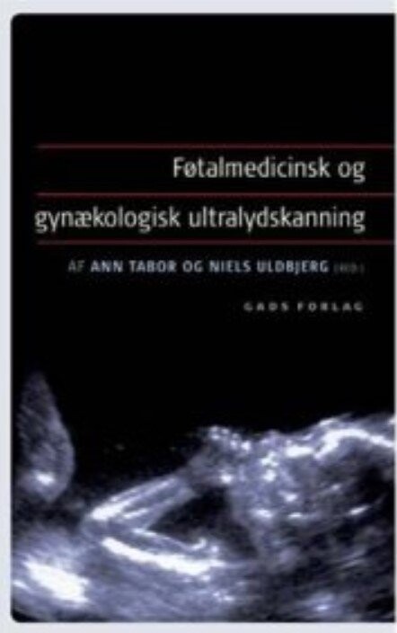 Føtalmedicinsk Og Gynækologisk Ultralydskanning   Ann Tabor   Bog