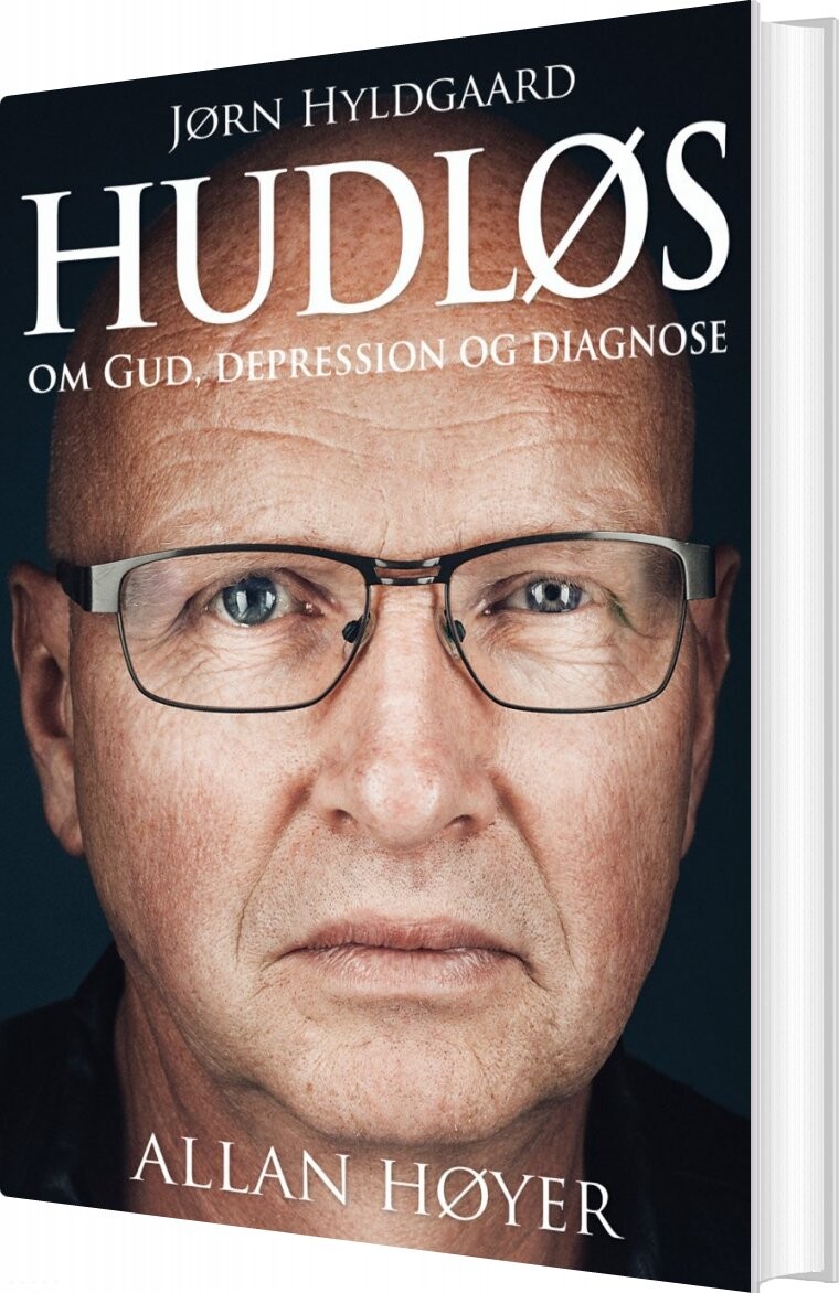 Hudløs   Allan Høyer   Bog