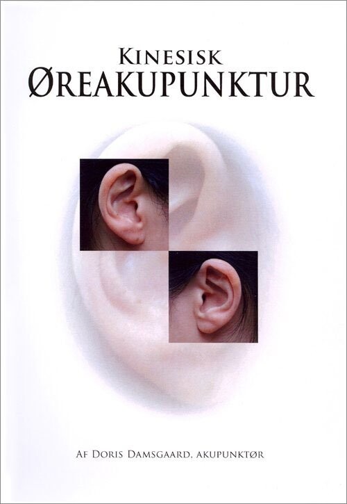 Kinesisk øreakupunktur   Doris Damsgaard   Bog