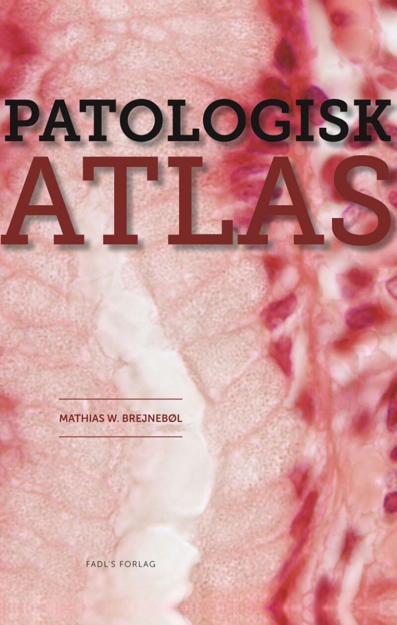 Patologisk Atlas   Mathias Willadsen Brejnebøl   Bog