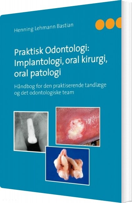 Praktisk Odontologi: Implantologi  Oral Kirurgi  Oral Patologi   Henning Lehmann Bastian   Bog