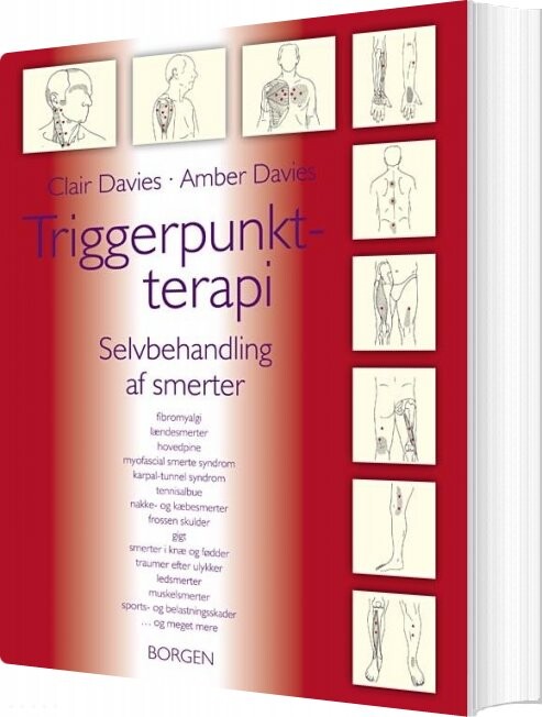 Triggerpunkt Terapi   Clair Davies   Bog