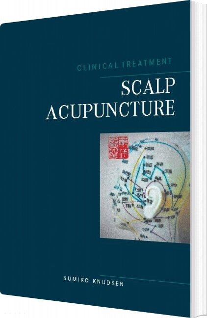 Scalp Acupuncture   Sumiko Knudsen   English Book